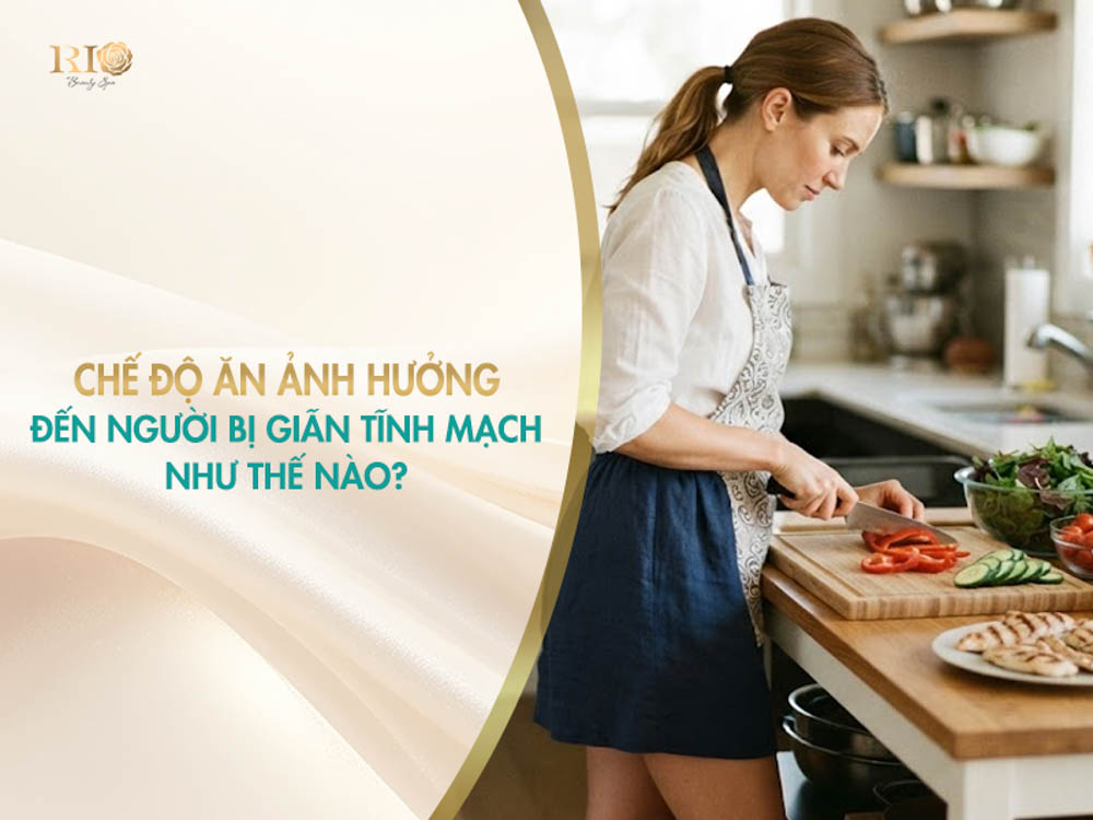 Phụ nữ chuẩn bị rau củ tươi giúp hiểu rõ giãn tĩnh mạch nên ăn gì để cải thiện tuần hoàn máu