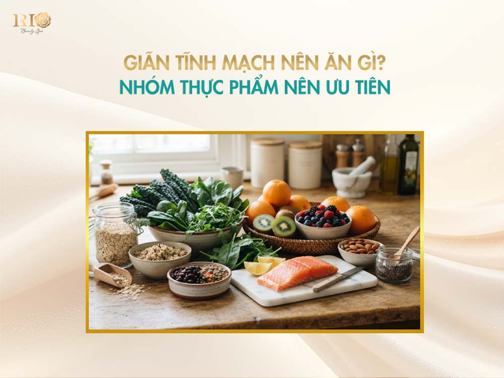 Các loại rau củ, trái cây giàu flavonoid và chất xơ giải đáp giãn tĩnh mạch nên ăn gì