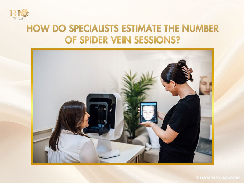An informative graphic highlighting four core factors—vessel size, lesion density, natural skin recovery rate, and total treatment area—that influence how many treatments for spider veins an individual needs.