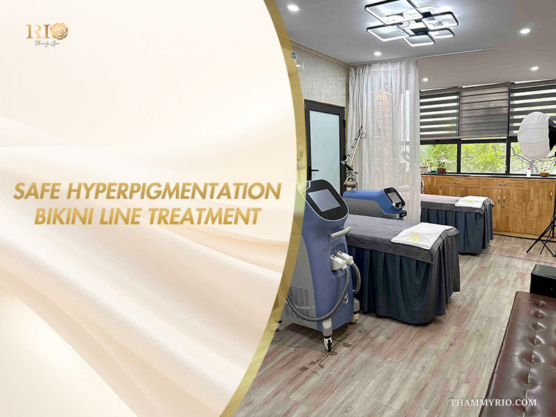 Private aesthetic suite with advanced laser platforms for safe hyperpigmentation bikini line treatment at Rio Beauty Clinic