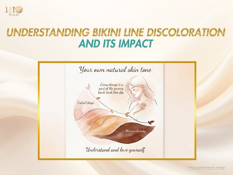 Watercolor art illustration explaining natural skin tone transitions and causes for hyperpigmentation bikini line treatment