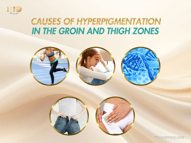 Diagram showing causes of hyperpigmentation before inner thigh bleaching