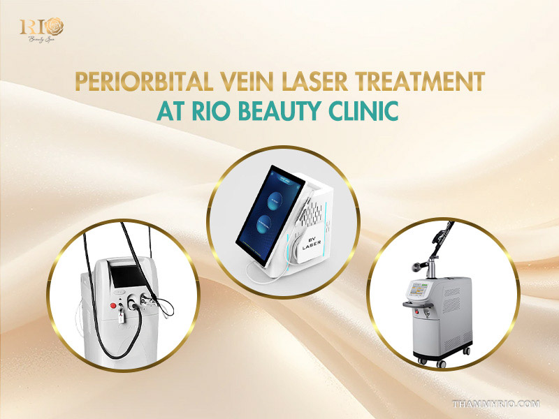 Advanced vascular laser workstations utilized for periorbital vein treatment at Rio Beauty Clinic