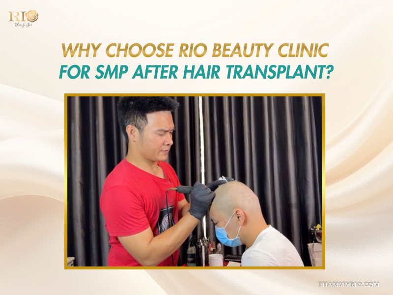 Technician performing SMP showing why choose Rio Beauty Clinic.