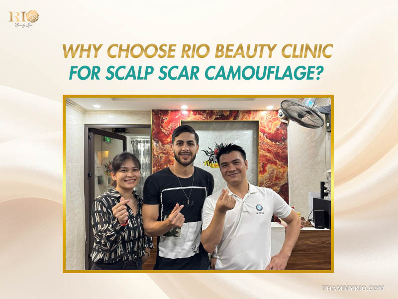 Happy client and specialists at Rio Beauty Clinic offering scalp micropigmentation for scars.