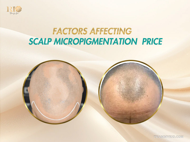 Before and after scalp photos showing factors affecting scalp micropigmentation pricing.