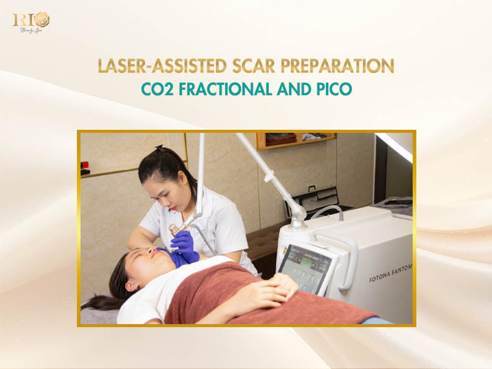 Specialist performing laser scar remodeling prior to administering a scar camouflage tattoo
