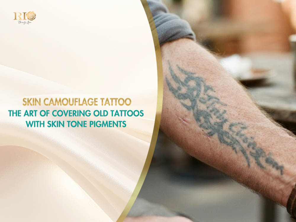Faded tattoo on a man's forearm illustrating the skin tone tattoo cover up method with camouflage pigments