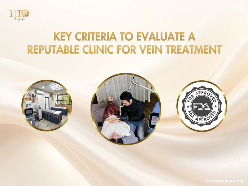 Key criteria to evaluate a reputable clinic for spider vein treatment near me in Hanoi