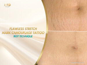 Flawless stretch mark camouflage tattoo best technique on stomach skin