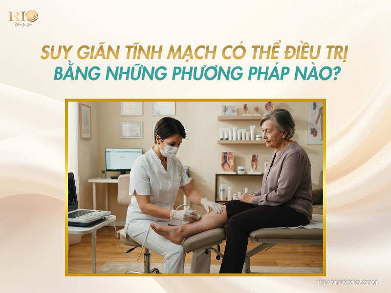 Bác sĩ siêu âm Doppler mạch máu chân giải đáp suy tĩnh mạch là gì và điều trị bằng phương pháp nào
