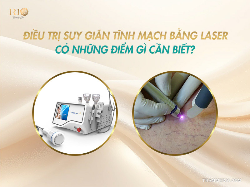 Thiết bị quang học và đầu laser xung dài xử lý triệt để mạch máu cho thắc mắc suy tĩnh mạch là gì