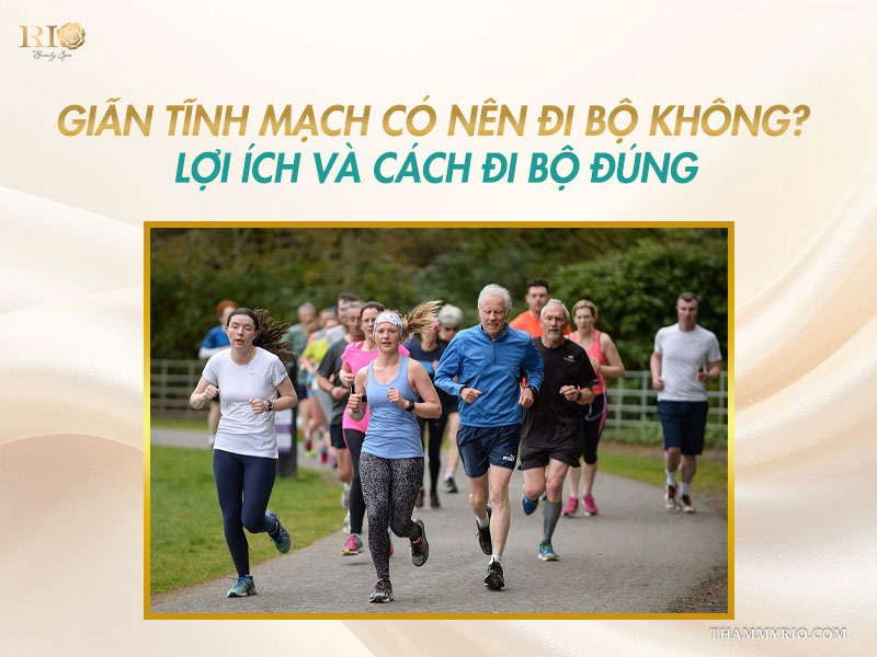Lợi ích và cách đi bộ đúng khi tìm hiểu tập thể dục cho người giãn tĩnh mạch.