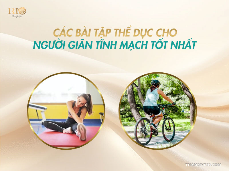 Các bài tập thể dục cho người giãn tĩnh mạch tốt nhất như đạp xe và yoga.