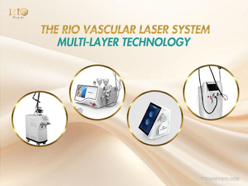 Four advanced vascular laser workstations utilized in multi-layer temple vein treatment