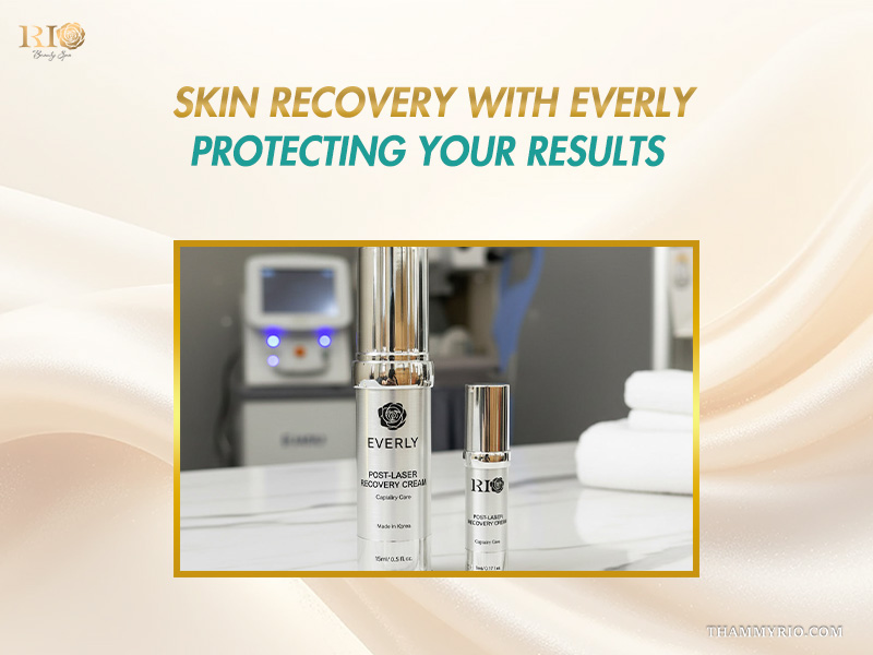 Everly Post-Laser Recovery Cream bottles displayed in a treatment suite for post-procedure temple vein treatment care