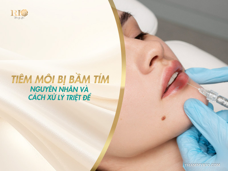 Cận cảnh quy trình thực hiện thẩm mỹ và nguyên nhân tiêm môi bị bầm.