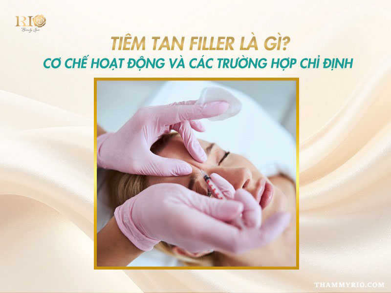 Cận cảnh quy trình thực hiện tiêm tan filler chuẩn y khoa cho khách hàng.