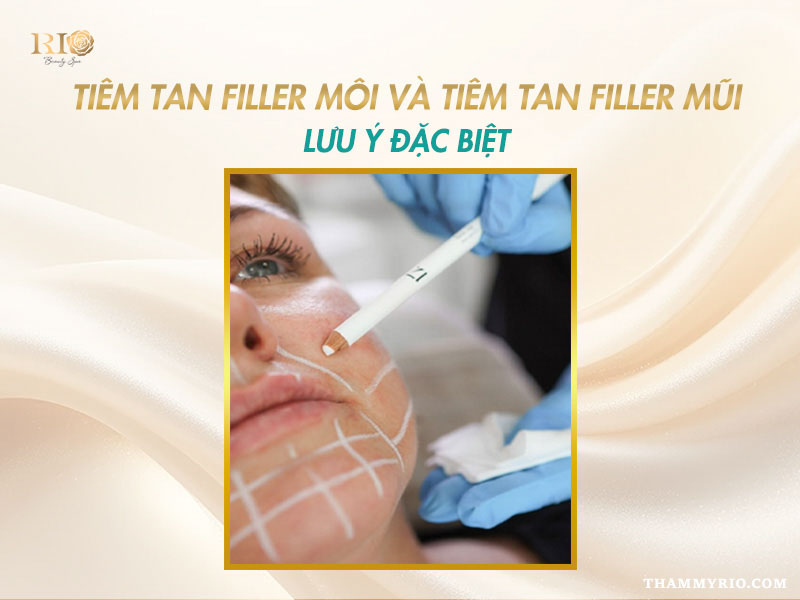 Bác sĩ thẩm mỹ kẻ vẽ định vị chính xác trước khi tiến hành tiêm tan filler.