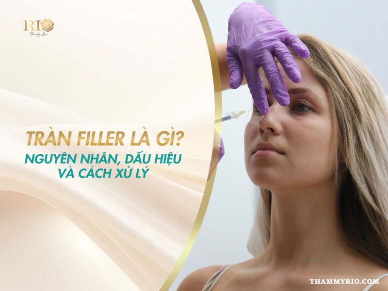 Khái niệm tràn filler là gì cùng nguyên nhân và cách xử lý.