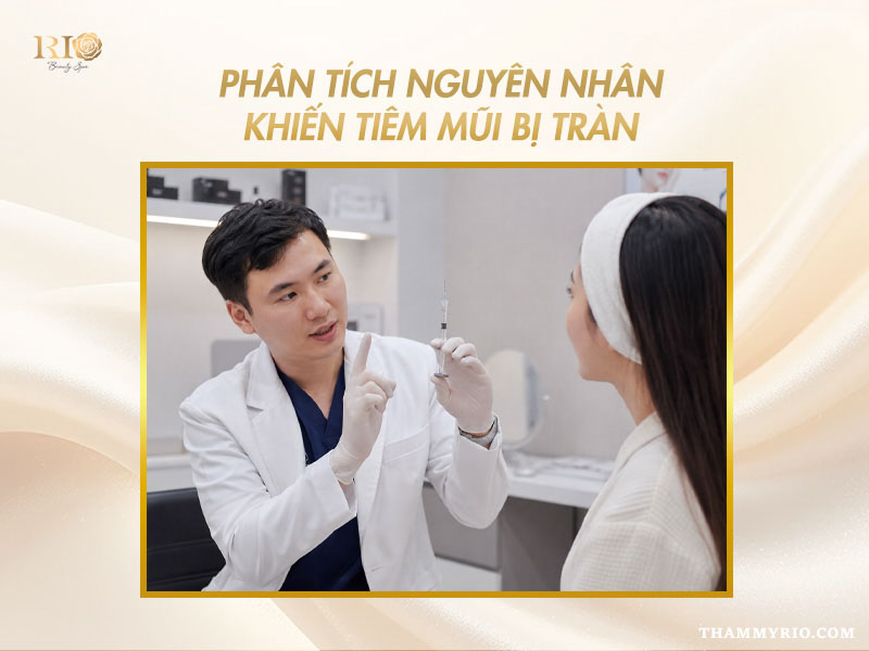 Bác sĩ phân tích chi tiết nguyên nhân gây tràn filler vùng mũi.