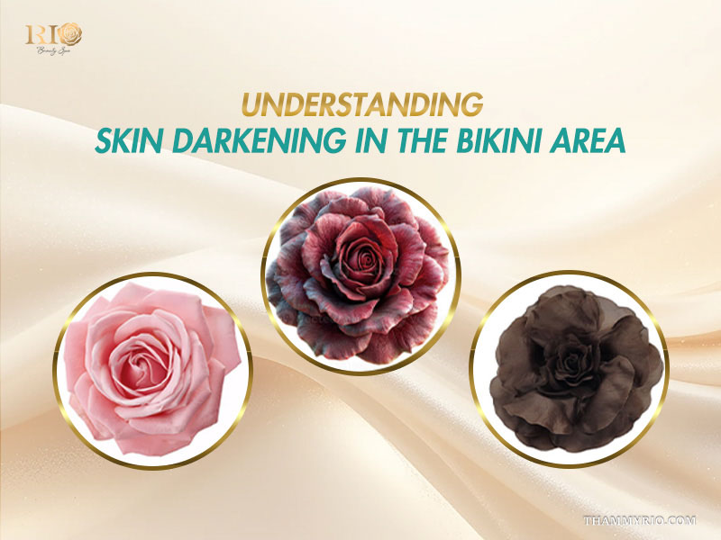 Three roses transitioning from bright pink to dark brown illustrating why people consider turmeric for bikini area hyperpigmentation
