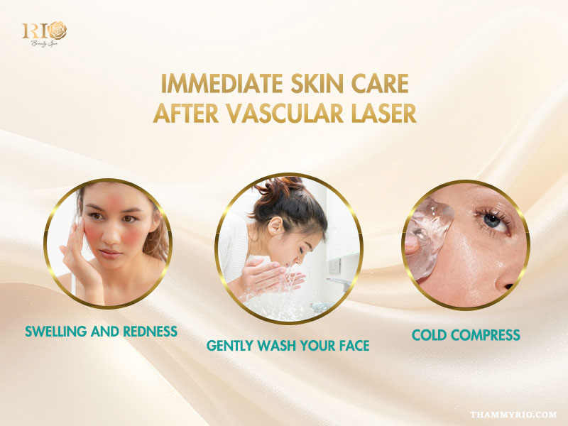mmediate skin care steps for vascular laser treatment aftercare including gentle washing and cold compress