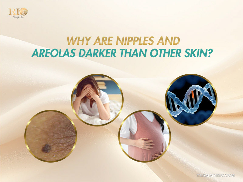 Primary causes of dark nipples and areolas including genetics and pregnancy.