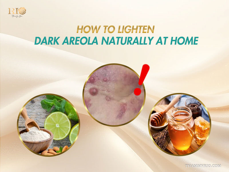 Natural home remedies to lighten dark areola and potential irritation risks.