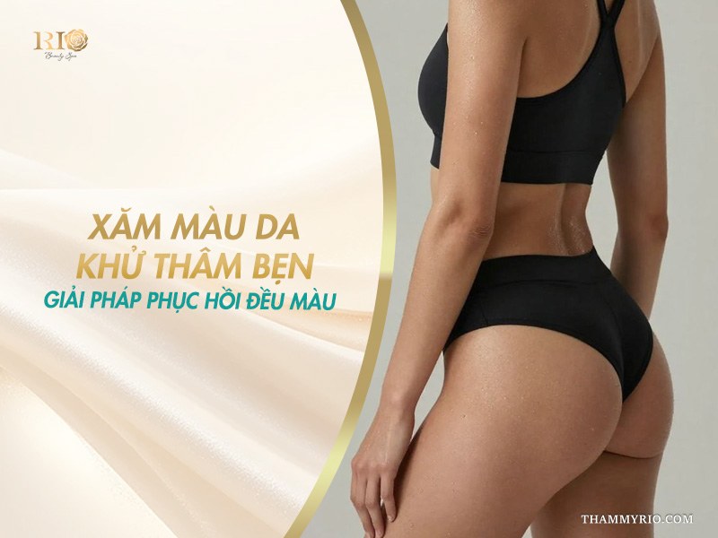 Vóc dáng thon gọn với làn da vùng đùi và bẹn mịn màng sau khi xăm màu da khử thâm bẹn