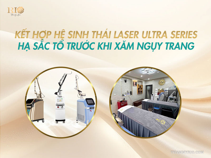 Hệ thống máy Rio Laser Ultra Series hỗ trợ hạ sắc tố trước khi xăm màu da khử thâm bẹ