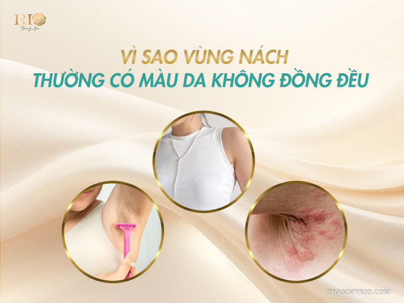 Thói quen cạo nhổ và viêm nang lông gây thâm sạm cần xăm màu da khử thâm nác