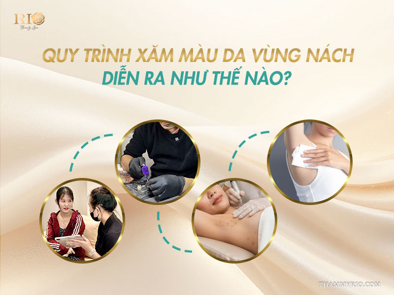 Quy trình 4 bước chuẩn hóa từ thăm khám đến thực hiện xăm màu da khử thâm nách