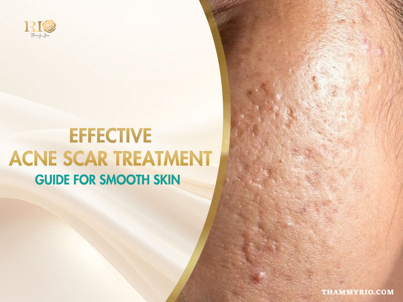 Face with indented blemishes needing professional acne scar treatment