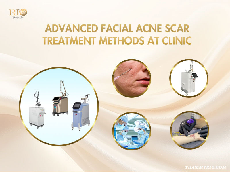 Modern clinical equipment used for advanced acne scar treatment