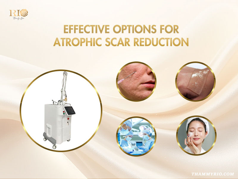 Medical tools and technology options for atrophic scar treatment