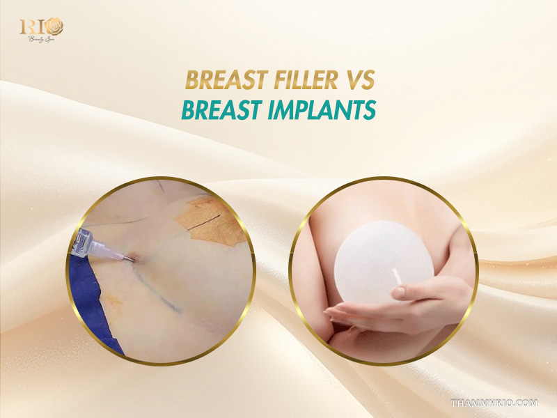 Visual comparison between a breast filler and traditional breast implants.