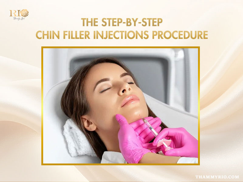Step by step chin filler procedure