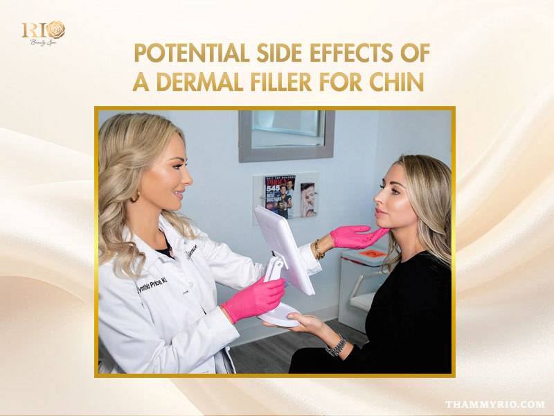 Dermal filler for chin consultation