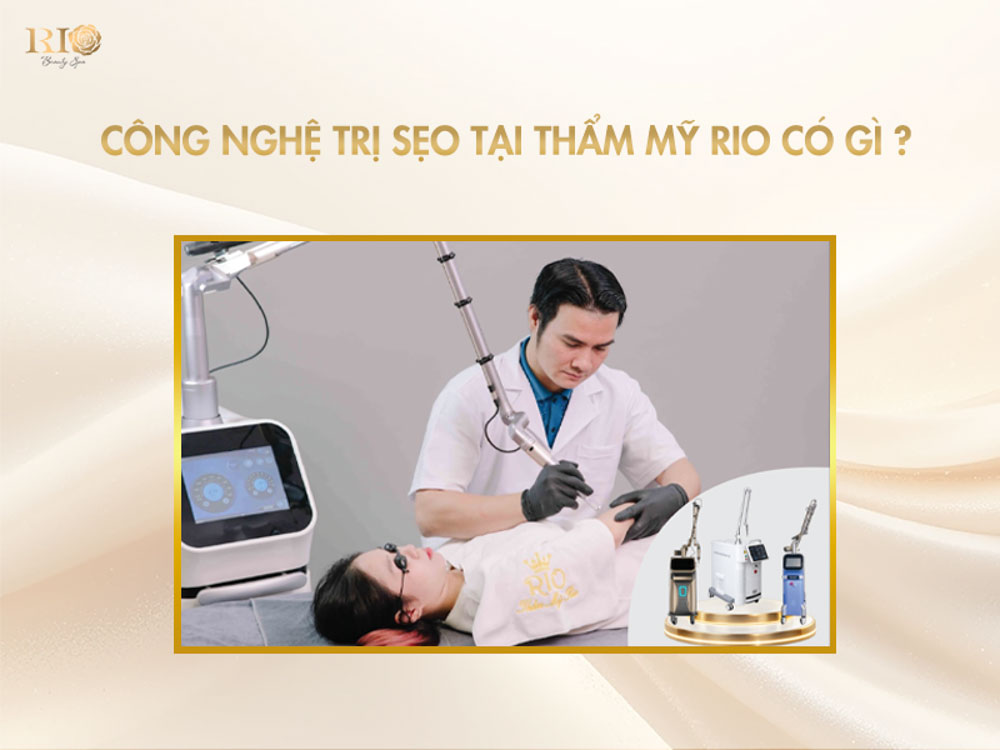 áp dụng công nghệ trị sẹo tại Thẩm mỹ Rio