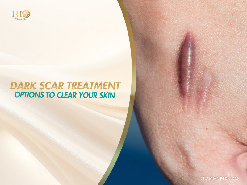 Close-up of dark scar for professional dark scar treatment