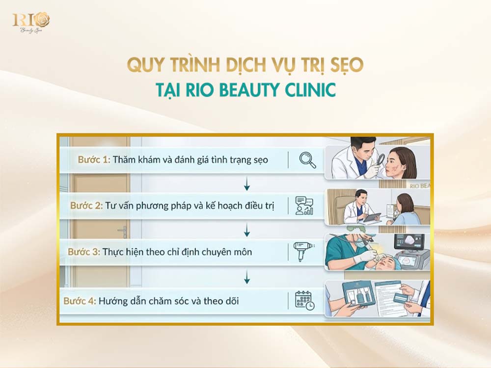 Sơ đồ 4 bước chuẩn y khoa trong Dịch vụ điều trị sẹo chuyên nghiệp tại Thẩm Mỹ Rio Beauty Clinic.