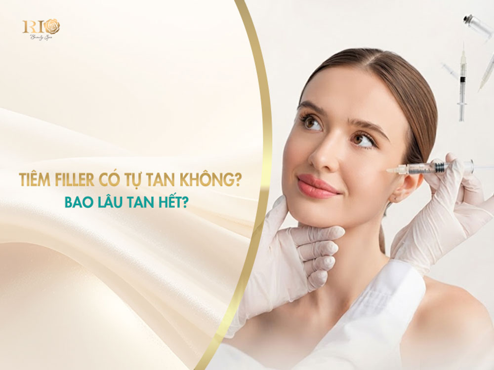 Thắc mắc về việc tiêm filler có tự tan không và thời gian tan hết.