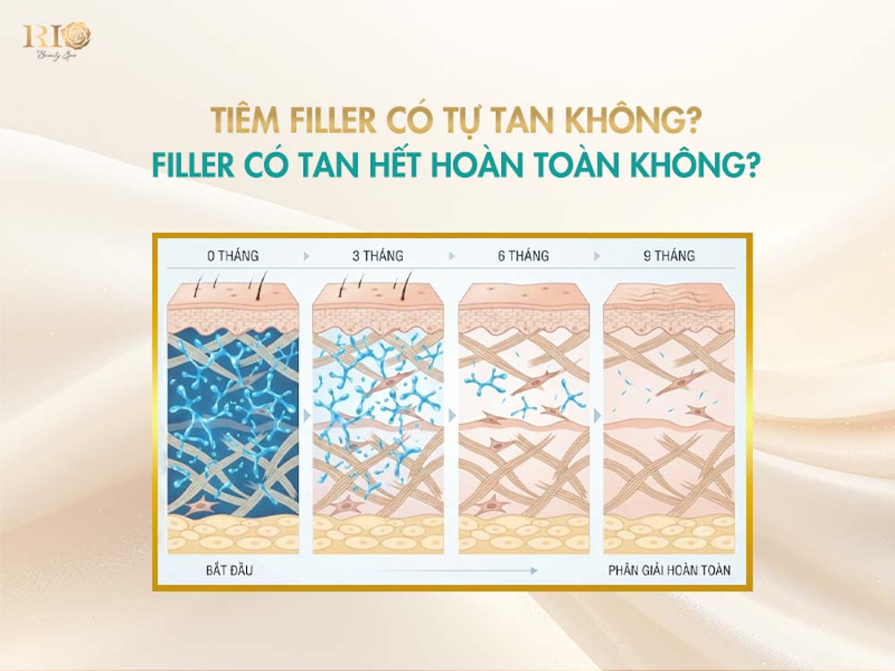 Sơ đồ quá trình phân giải giải đáp filler có tự tan không.