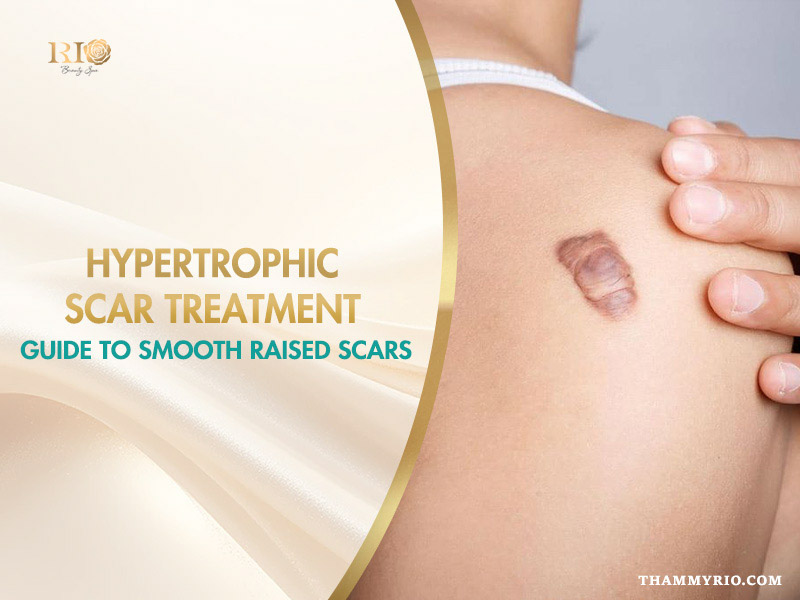 Raised scar on shoulder before hypertrophic scar treatment