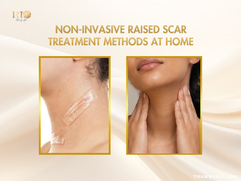 Silicone sheet applied for hypertrophic scar treatment at home