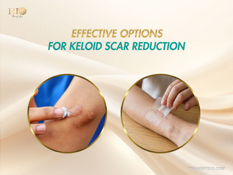Keloid scar treatment options using topical cream and silicone gel sheets
