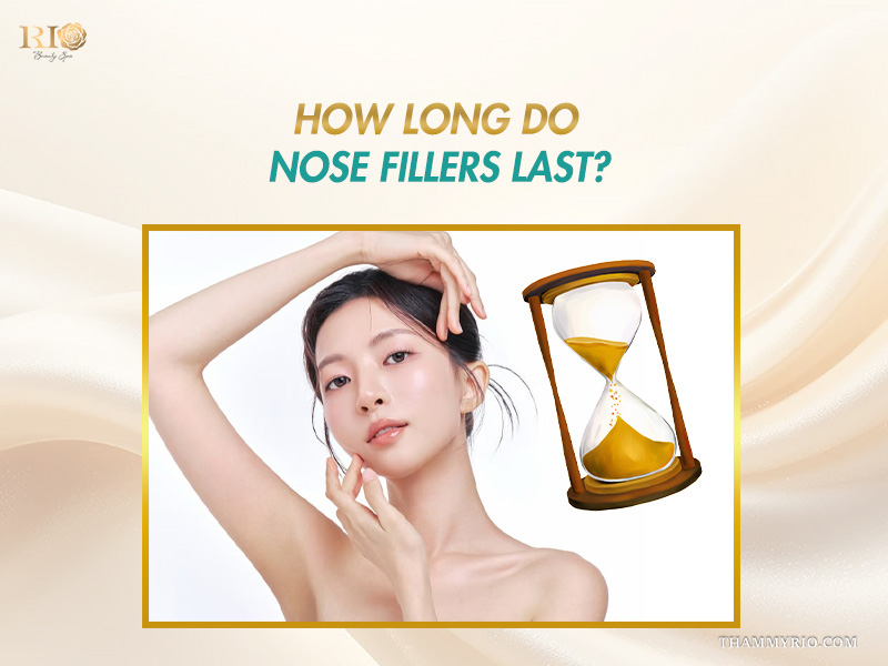 Woman posing next to an hourglass representing nose filler duration.