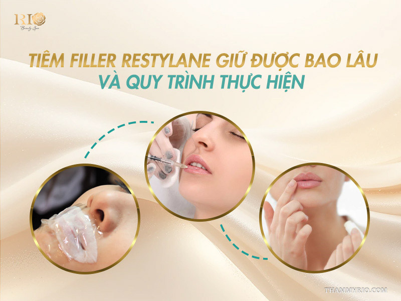 Quy trình thực hiện sau khi biết Restylane của nước nào.