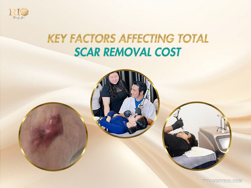 Key factors affecting total scar treatment cost in clinics